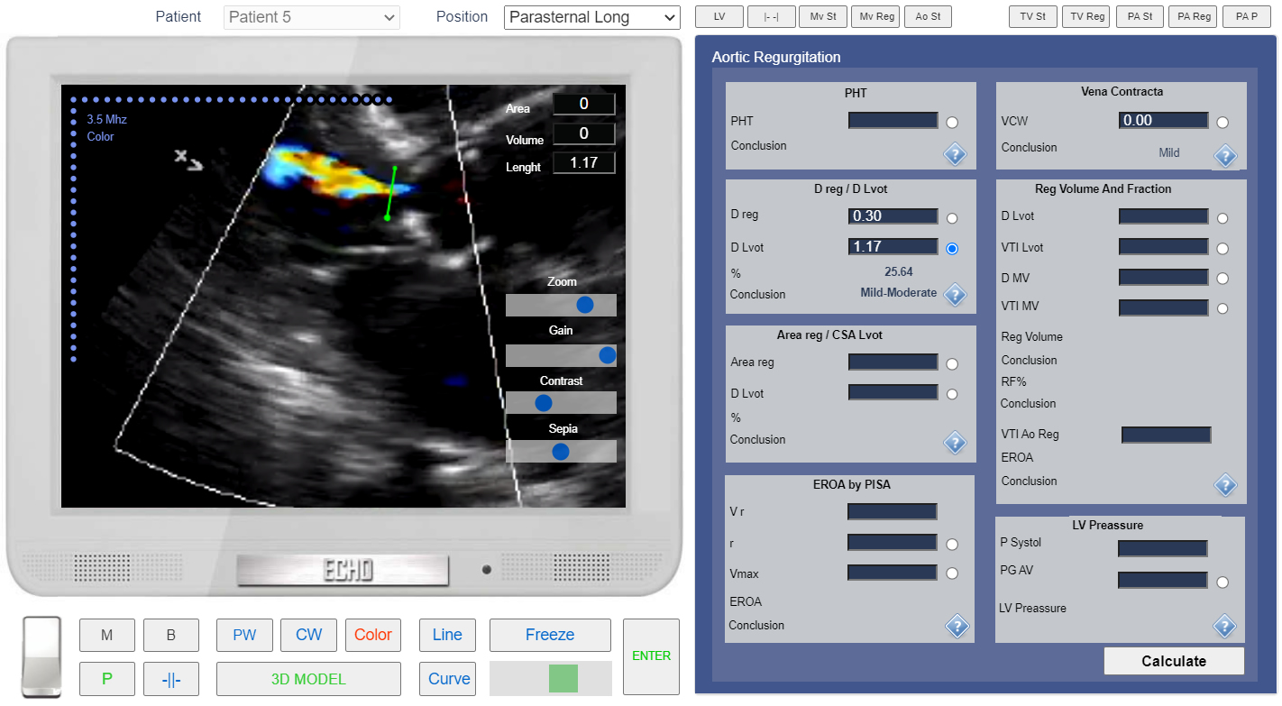 How To Measure Lvot Diameter Echo At Stan Denham Blog How To Measure Lvot Diameter Echo At Stan Denham Blog