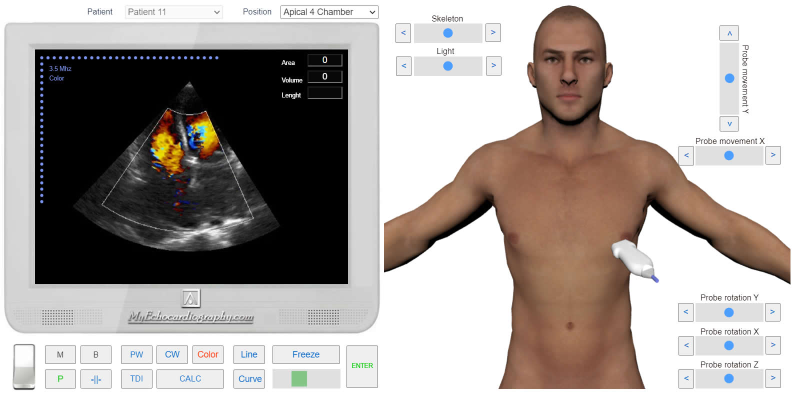 Diastolic_flow