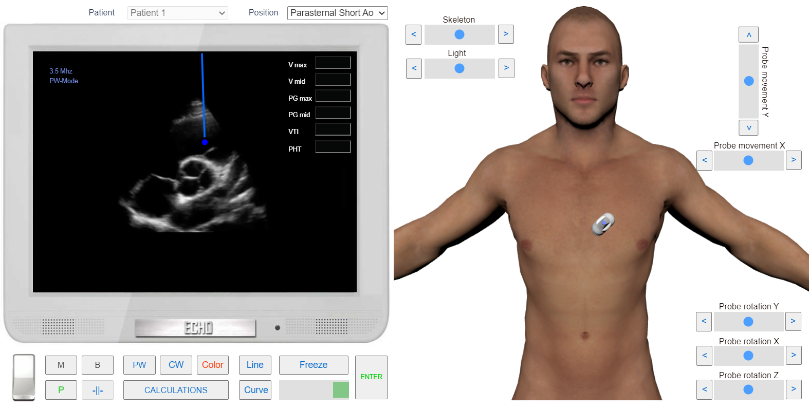 assessment of Pulmonary Regurgitation