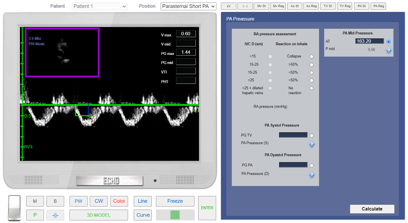 assessment of Pulmonary Regurgitation