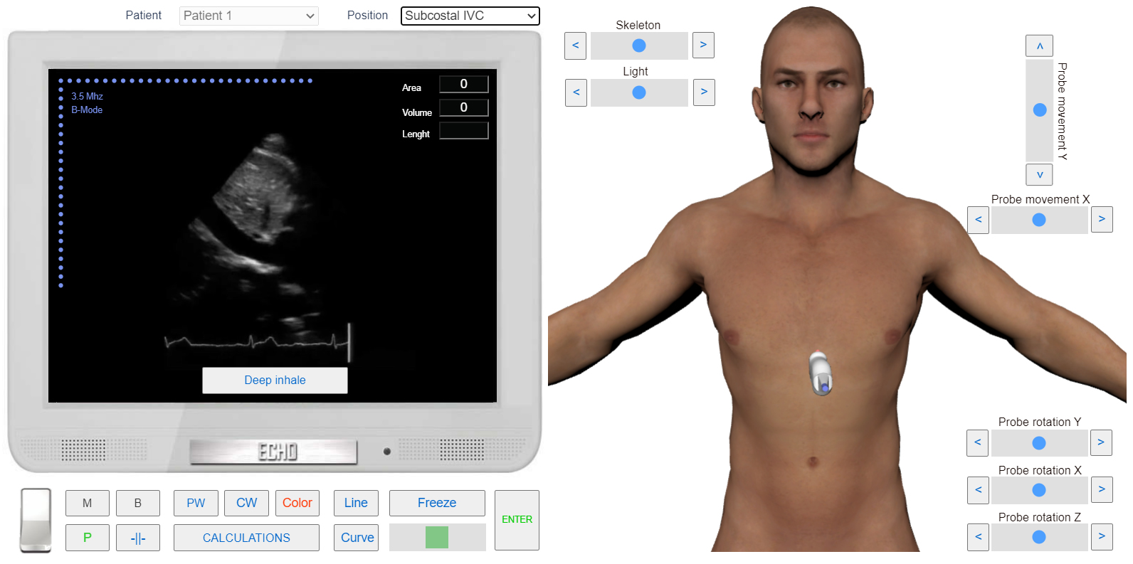 assessment of Pulmonary Regurgitation