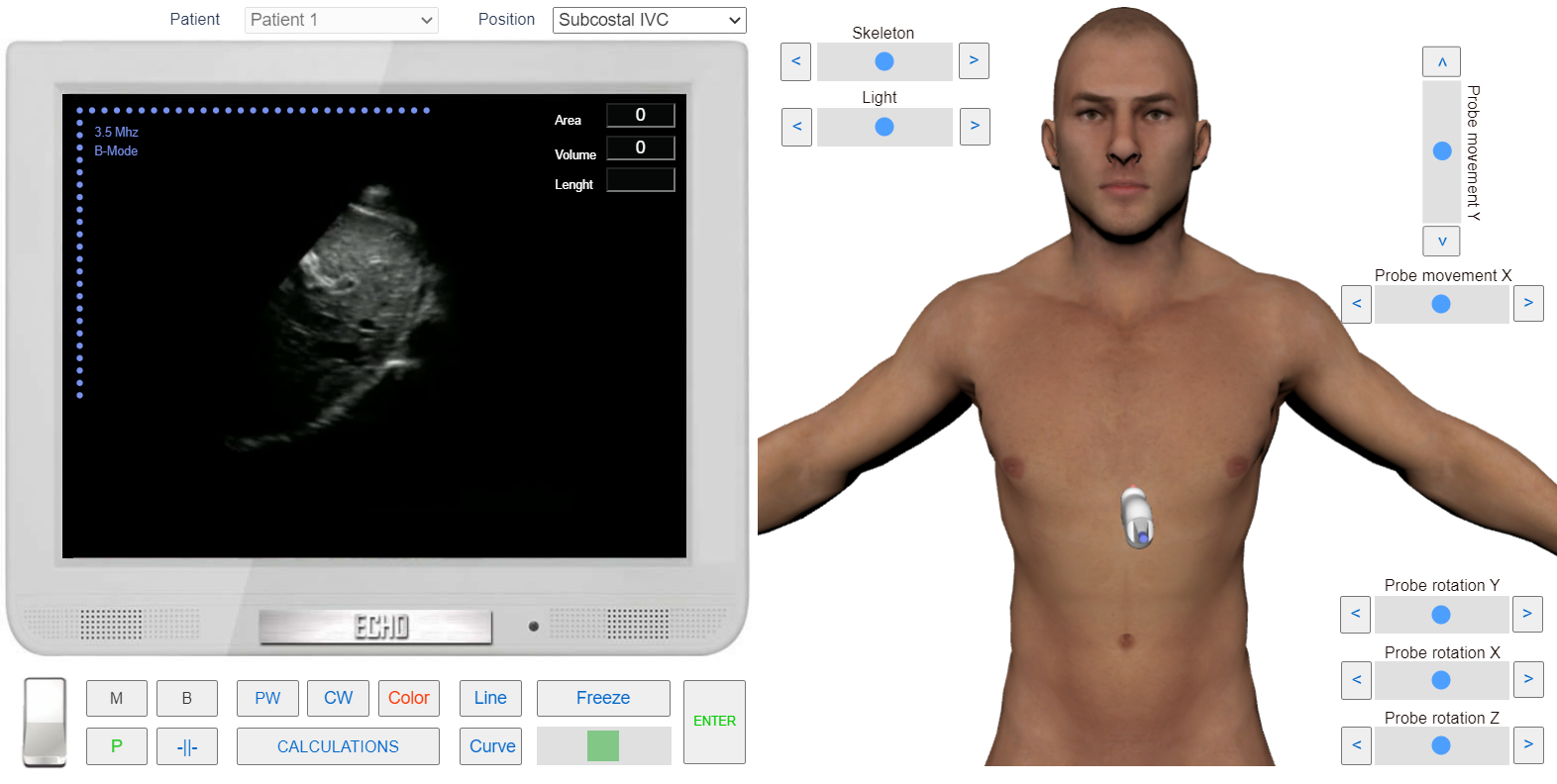 assessment of Pulmonary Regurgitation