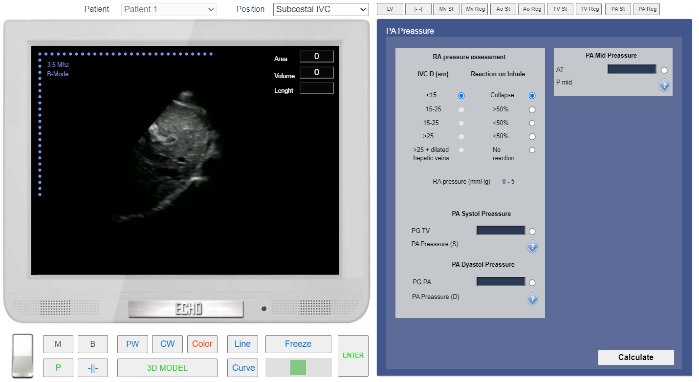 assessment of Pulmonary Regurgitation