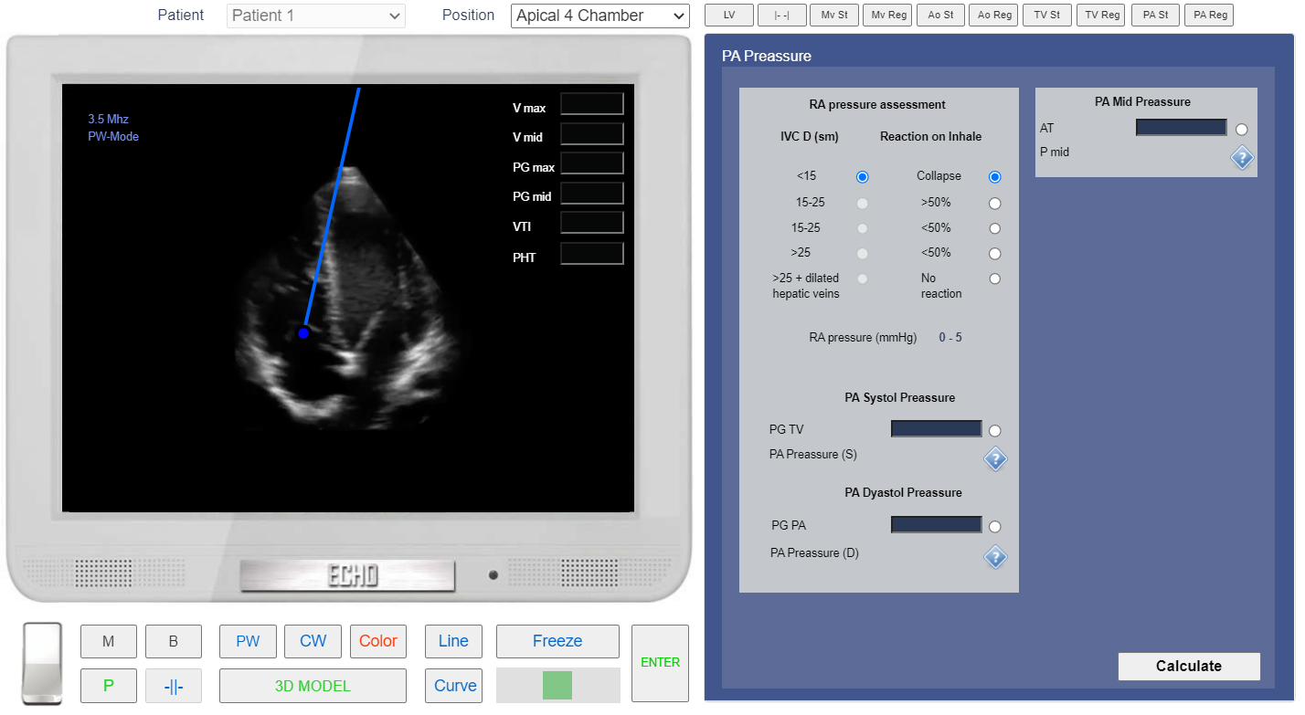 assessment of Pulmonary Regurgitation