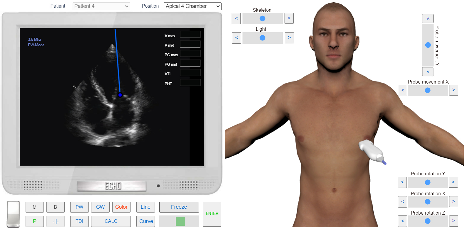 Diastolic_flow