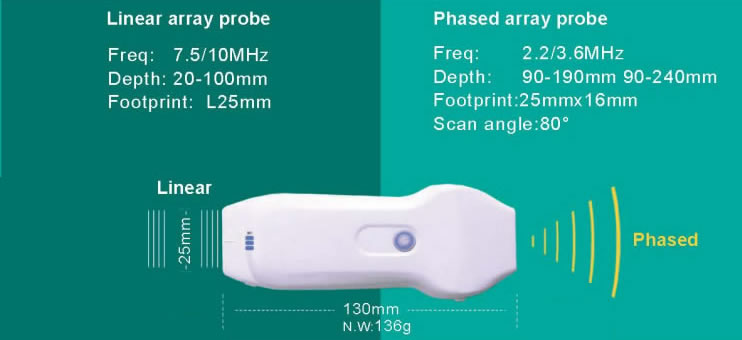 Diastolic_flow